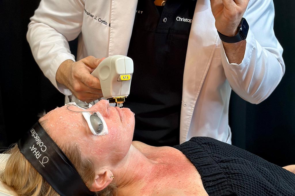 BBL Treatment performed on face